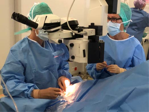 Chirurgie cataracte